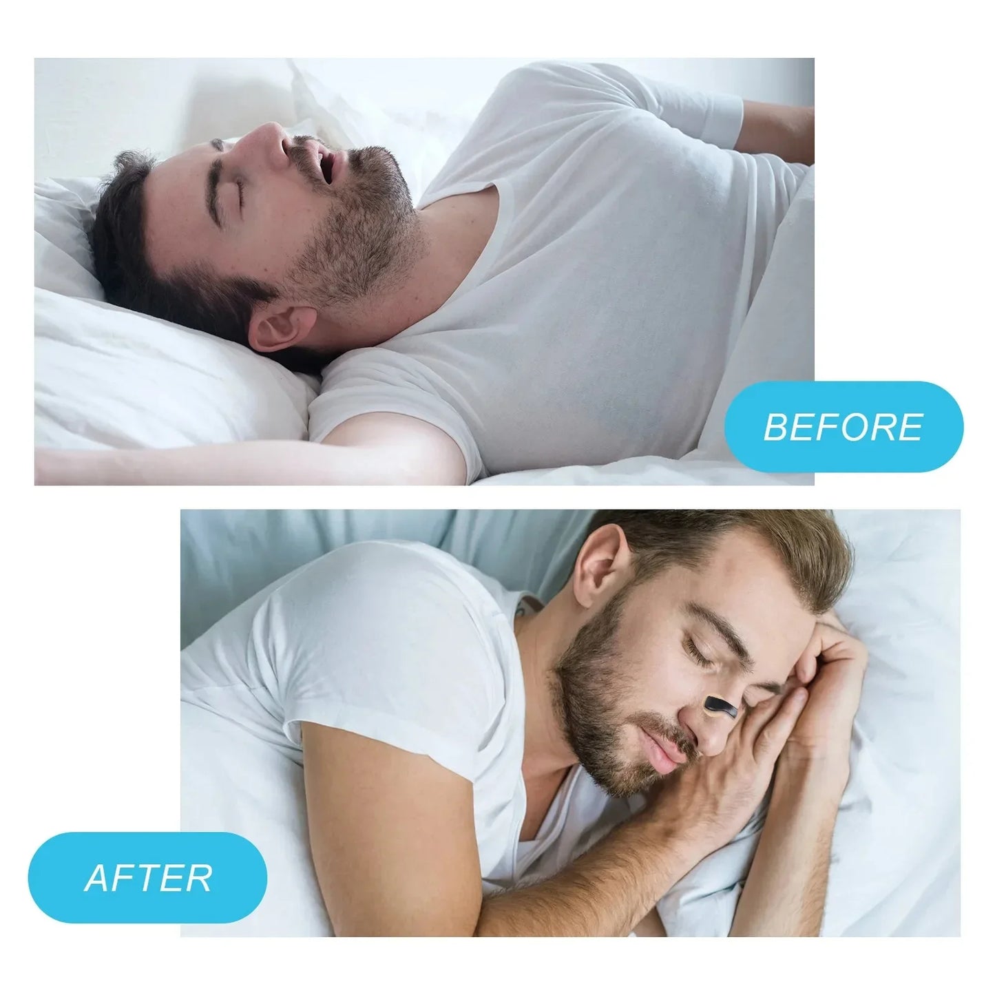 Dilatador Nasal Magnetico Forhia AirMax – Respira Mejor, Vive Mejor