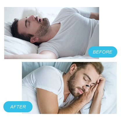 Dilatador Nasal Magnetico Forhia AirMax – Respira Mejor, Vive Mejor